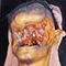 Cera anatomica, Museo di Anatomia Patologica dell'Universit� degli Studi di Firenze.