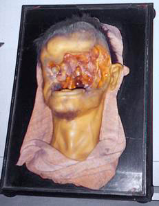 Anatomical wax model, Museum of Pathological Anatomy, University of Florence.