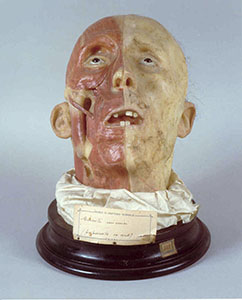 Anatomic wax, Museo Anatomico "Leonetto Comparini", University of Siena.
